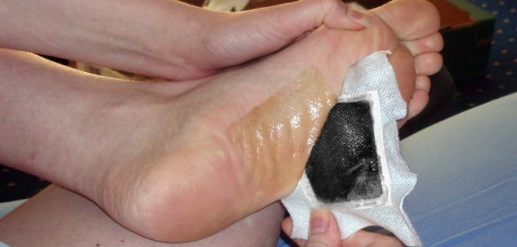removing PureFeet patches from feet